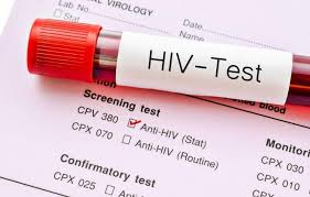 KETAHUI SEMUA DETAIL HIV DAN AIDS - Bagian 2